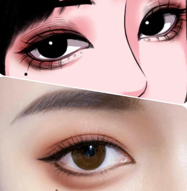 眉提升术