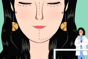 眼袋去除术国内领先医院名单公布！告别浮肿，重拾青春眼神