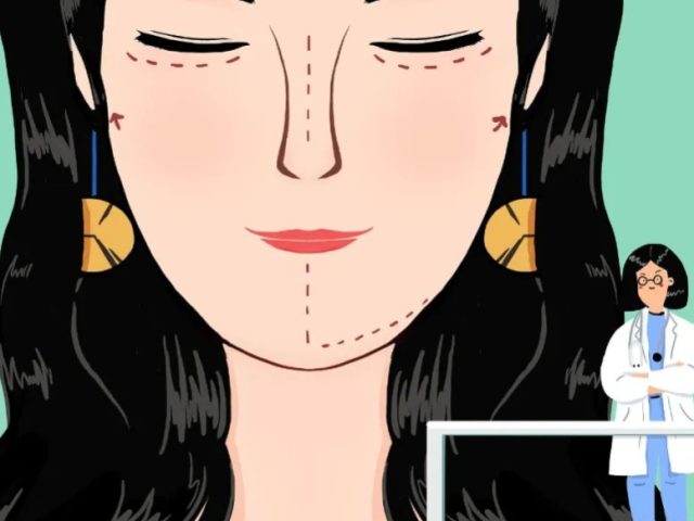 鼻基底填充