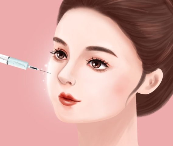 玻尿酸填充